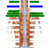 Initial Visit: Migraines, neck pain and numbness